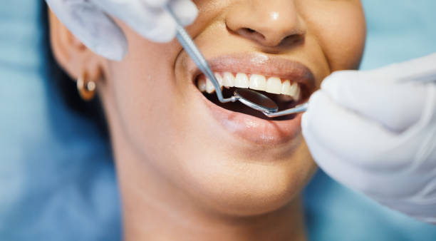 Best Emergency Dental Care for Broken or Chipped Teeth in Aurora, OH